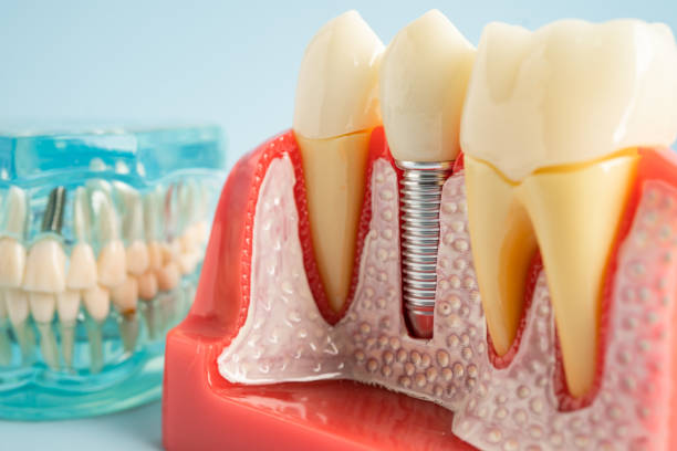 Professional Dental Services in Big Bear Lake, CA